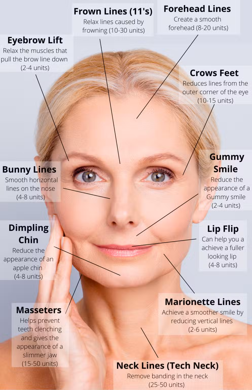 Crown Lines