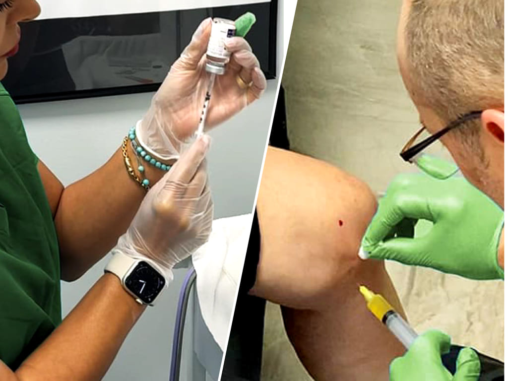 PRP therapy